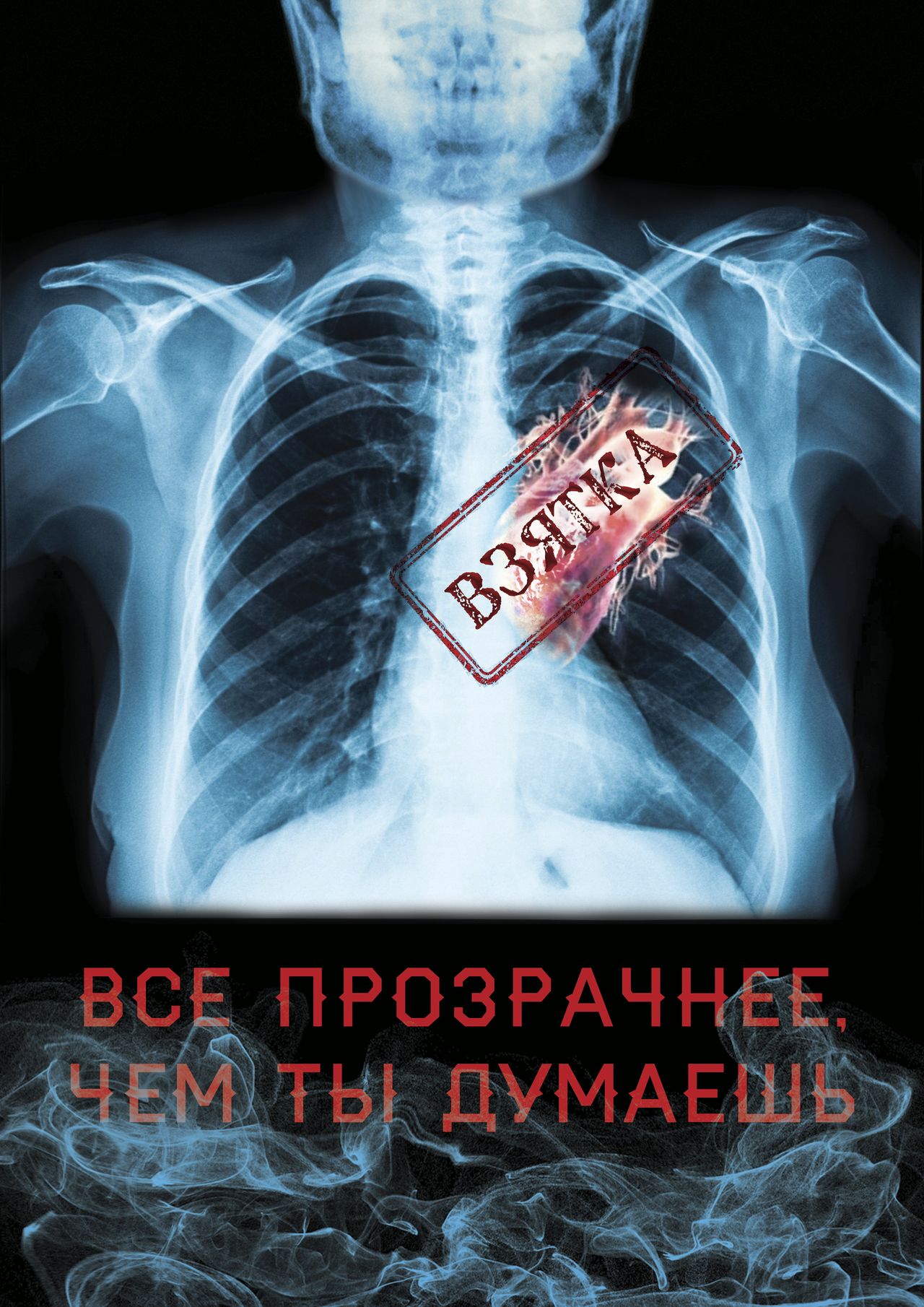 Ne pozvolyaj korrupcii upravlyat mirom (Boku Viktoriya)